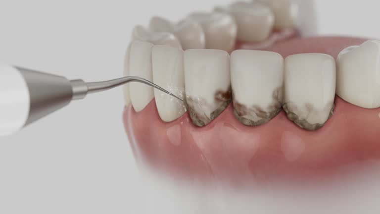Trusted Teeth Cleaning And Checkup service in Island Lake, IL - Dentist Open Now